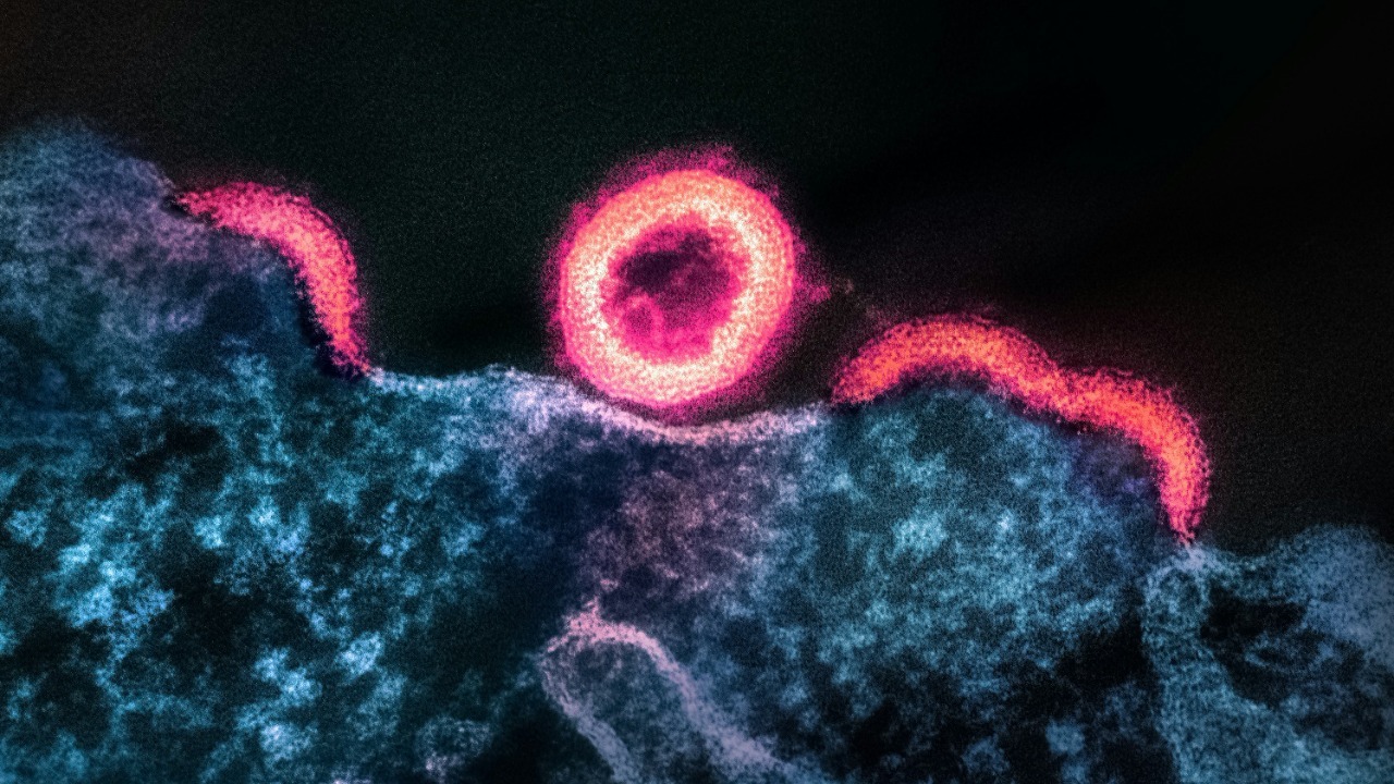 Aging immune cells may edit their own DNA to stay inflamed