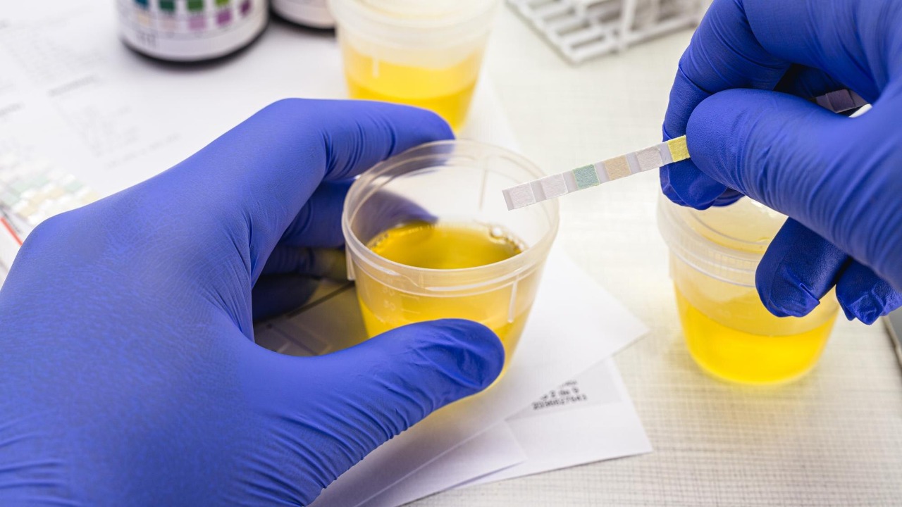 New urine test claims to reveal your real biological age