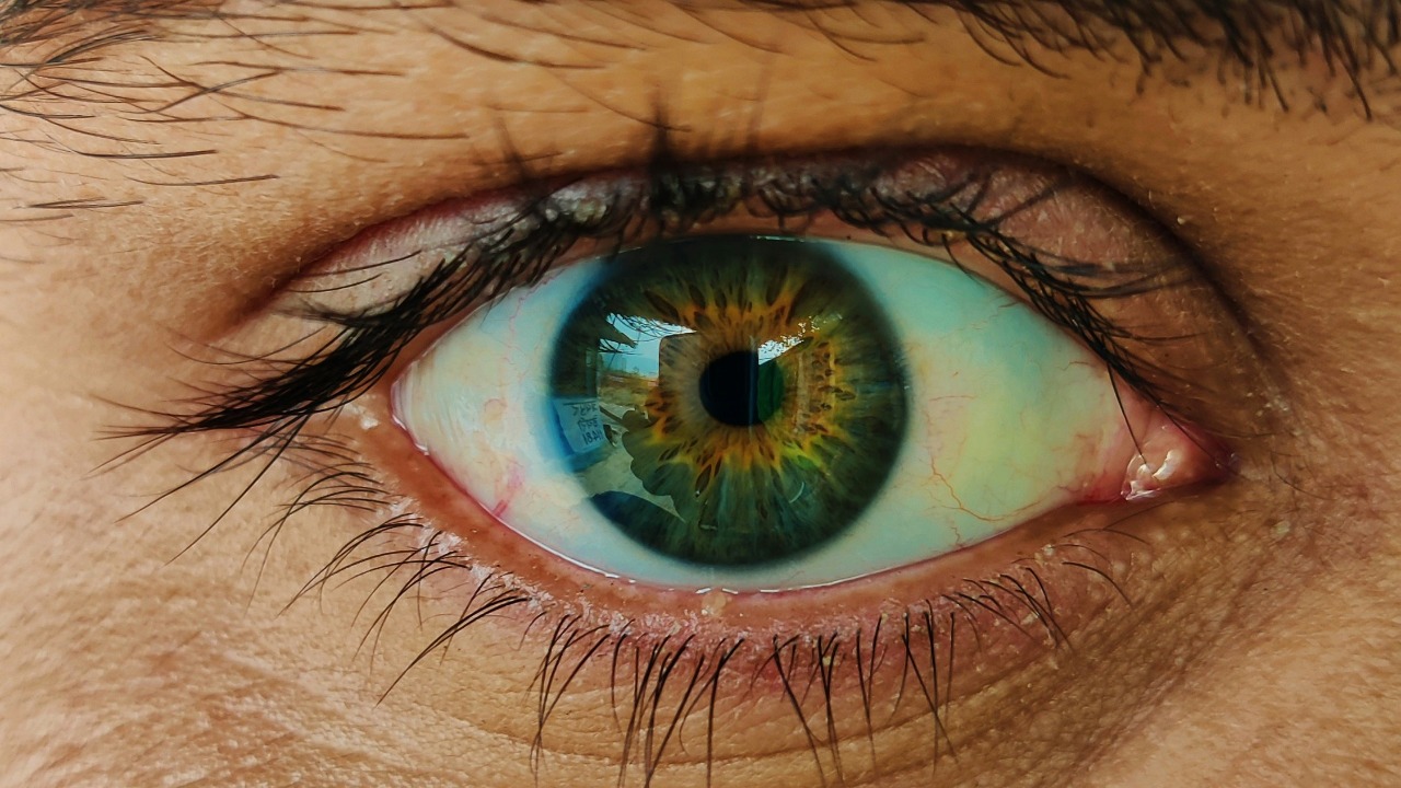 Your eyes can sparkle like lights, and it’s caused by a rare condition