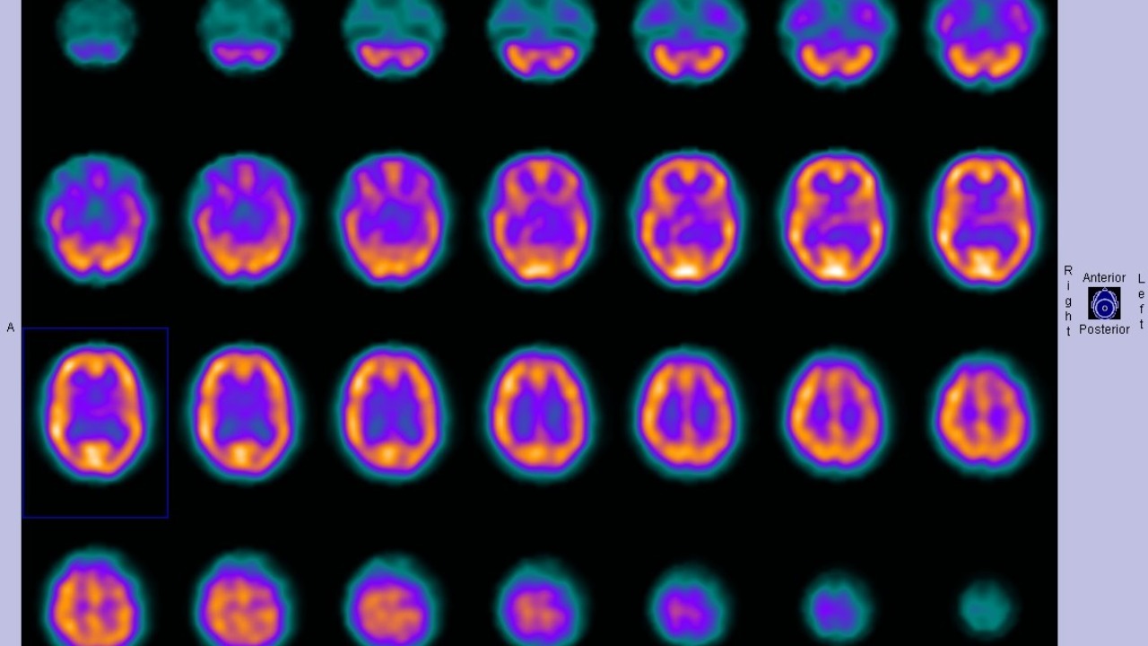 Image Credit: Dr Bruno Di Muzio - CC BY-SA 3.0/Wiki Commons