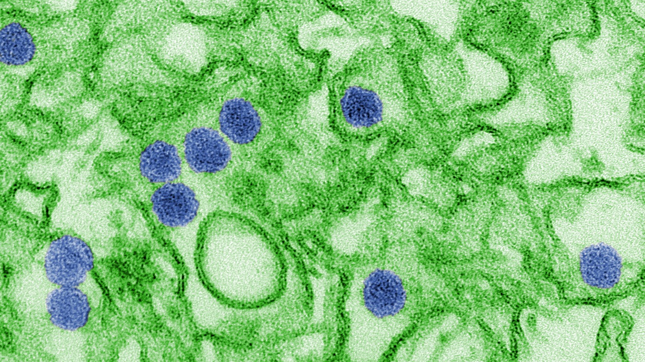 This common virus hits almost everyone, but why do only a few get crushed?