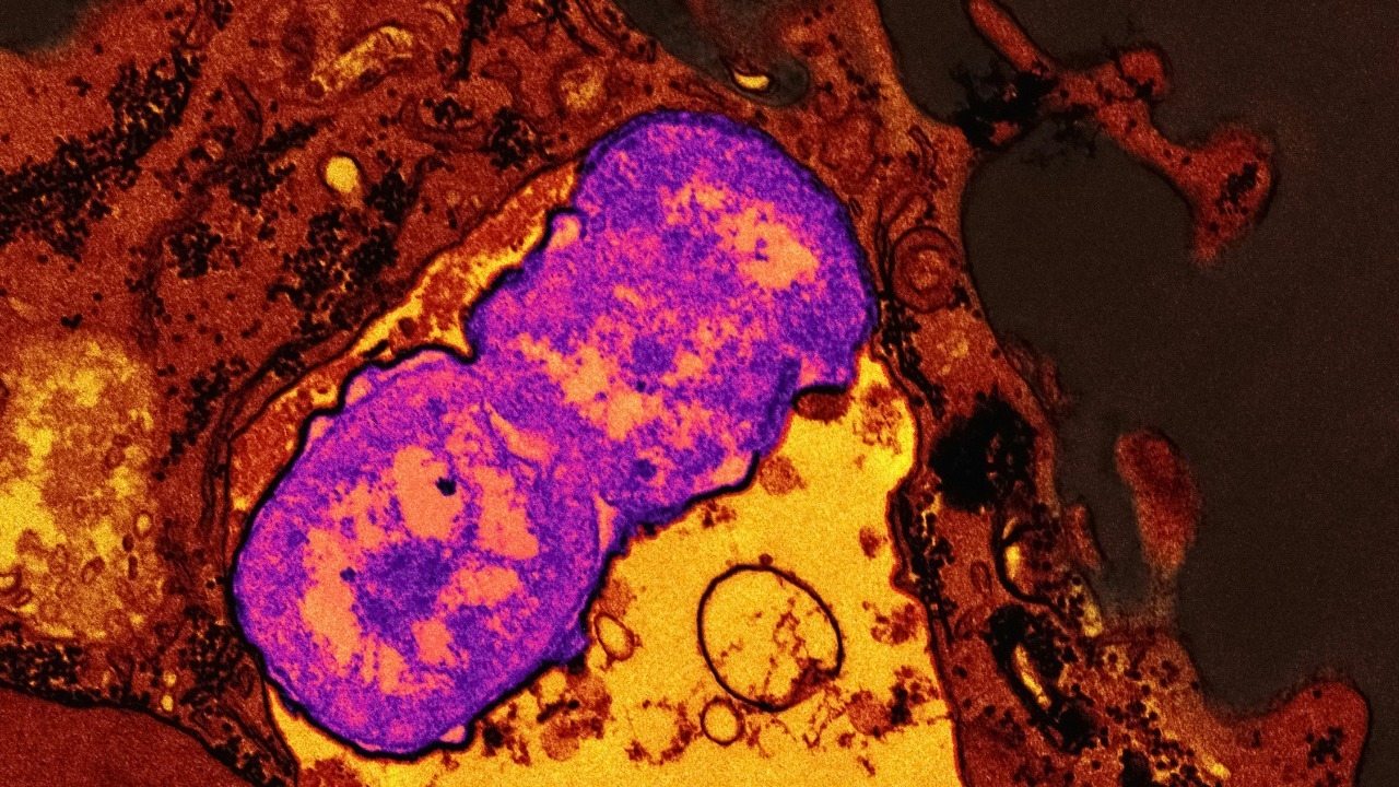 Triple-drug combo vaporizes pancreatic cancer in stunning mouse trial
