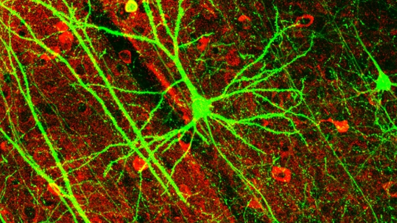 Forever chemicals tied to multiple sclerosis in alarming new study