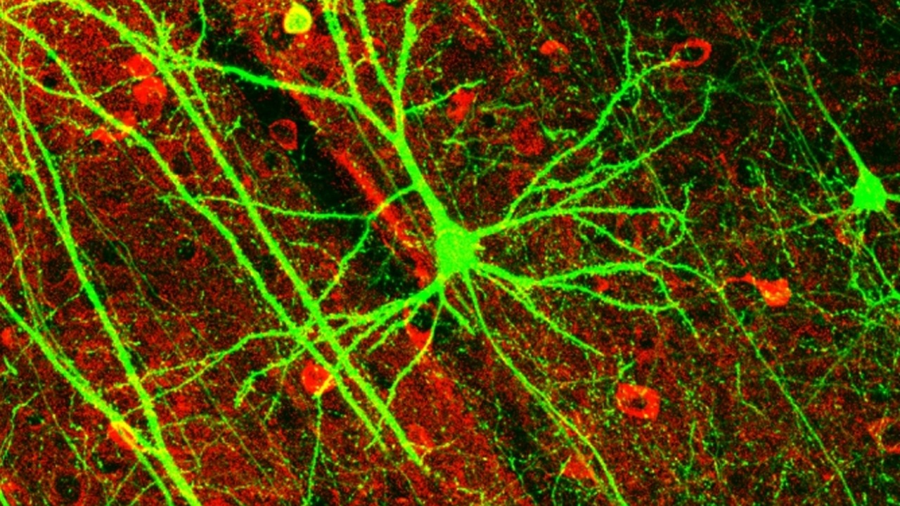 Image Credit: Wei-Chung Allen Lee, Hayden Huang, Guoping Feng, Joshua R. Sanes, Emery N. Brown, Peter T. So, Elly Nedivi - CC BY 2.5/Wiki Commons