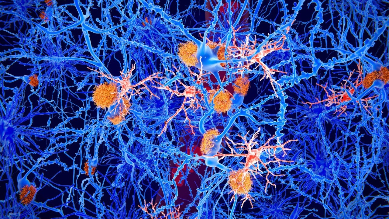 Scientists finally find the missing link between Parkinson’s protein and brain cell death