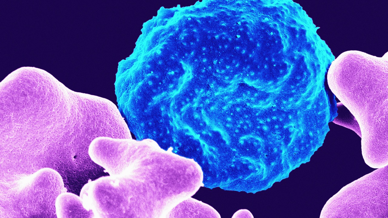 Scientists say they’ve cracked a key clue to beating this deadly cancer