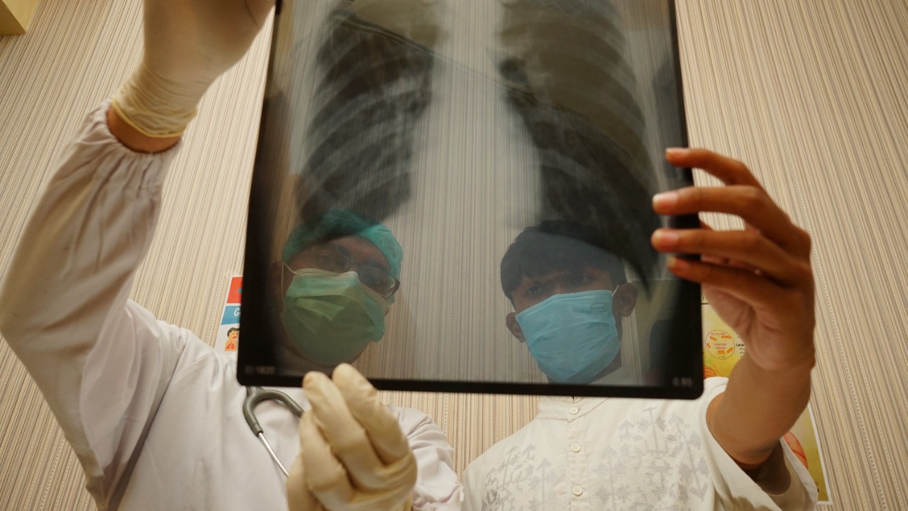 From scarred lungs to diabetes, how COVID may haunt survivors for years