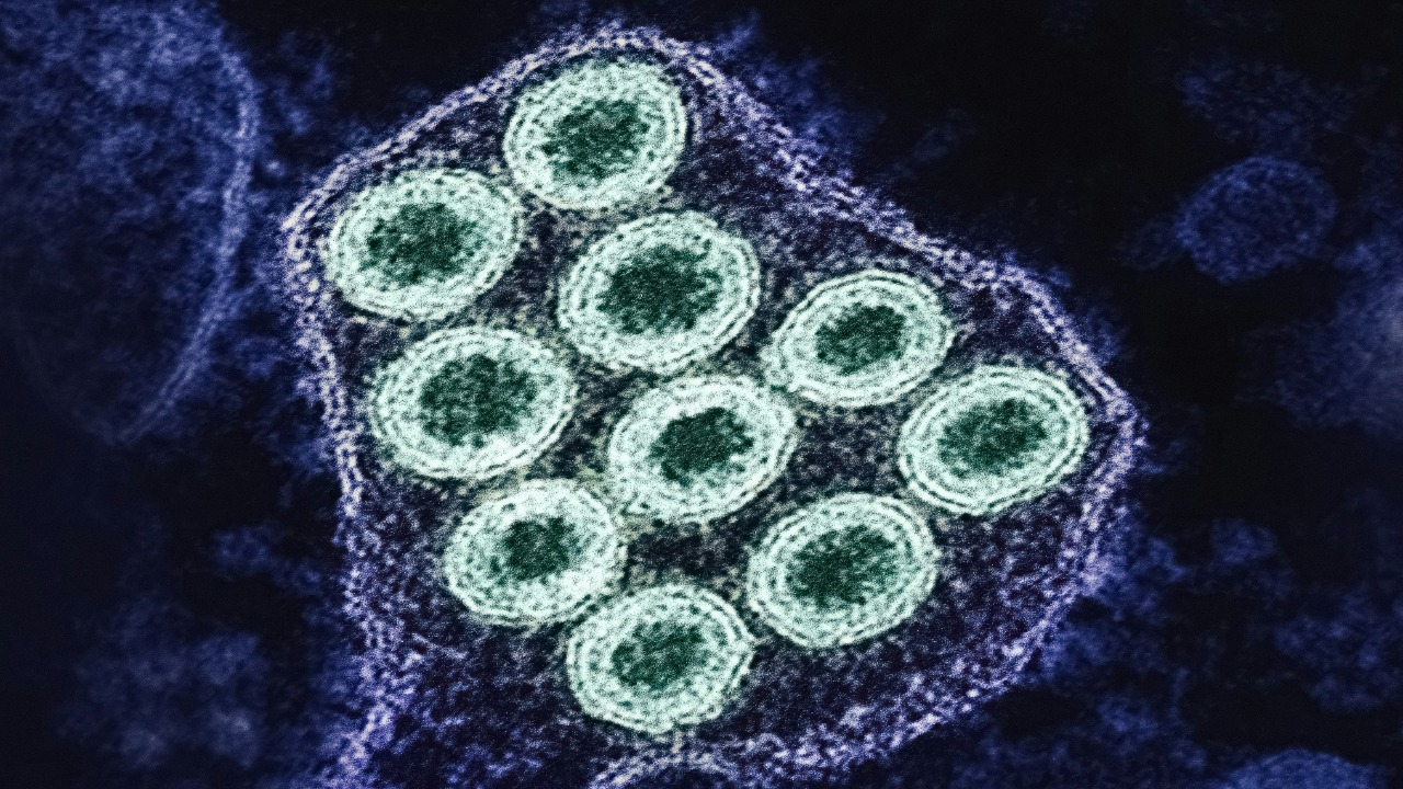 Giant virus in Japanese pond may rewrite origin of complex life