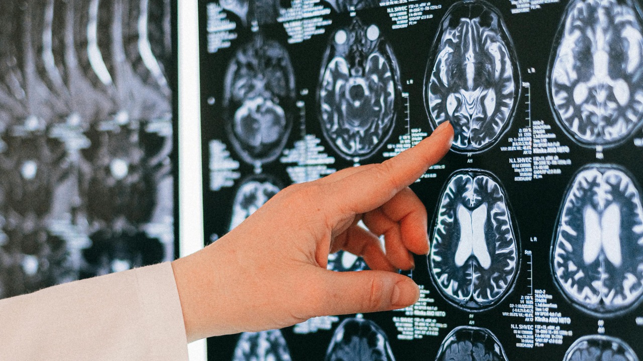 How shocking berry dye side effects could be rewiring your brain