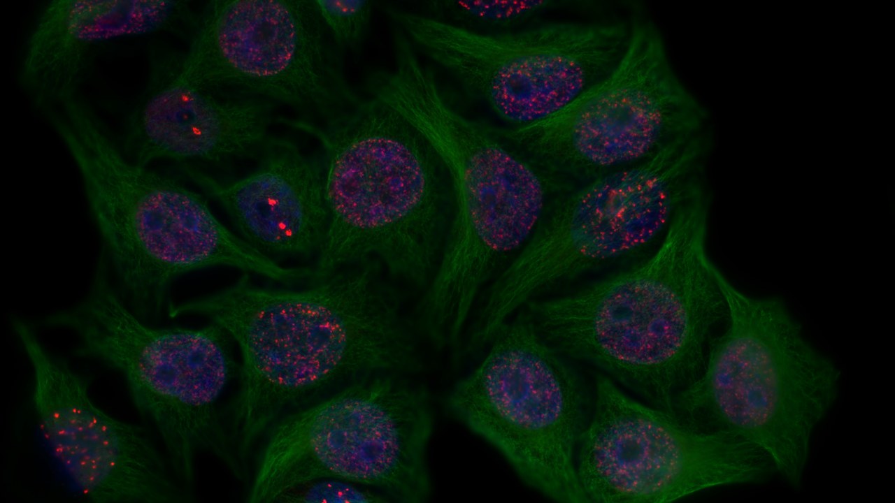 Cellular senescence — Image Credit: Velichko Artem - CC BY 4.0/Wiki Commons